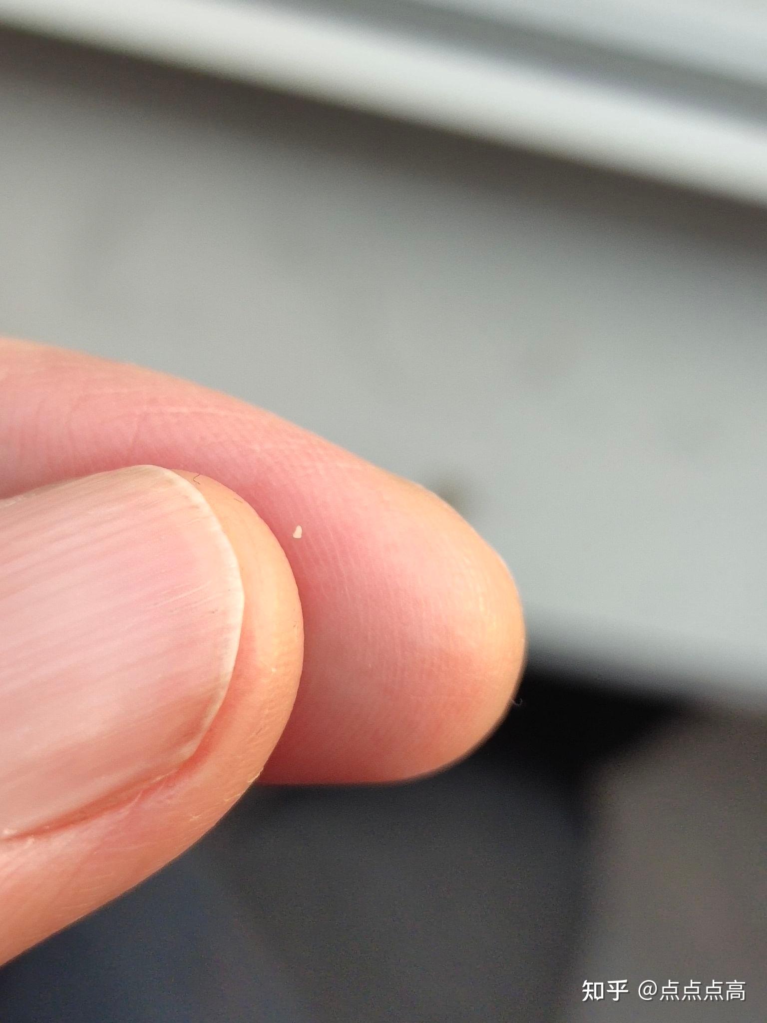 会咬人的白虫子,在地面往你脚上跳,在被窝里面还会屡屡爬,衣服裤子