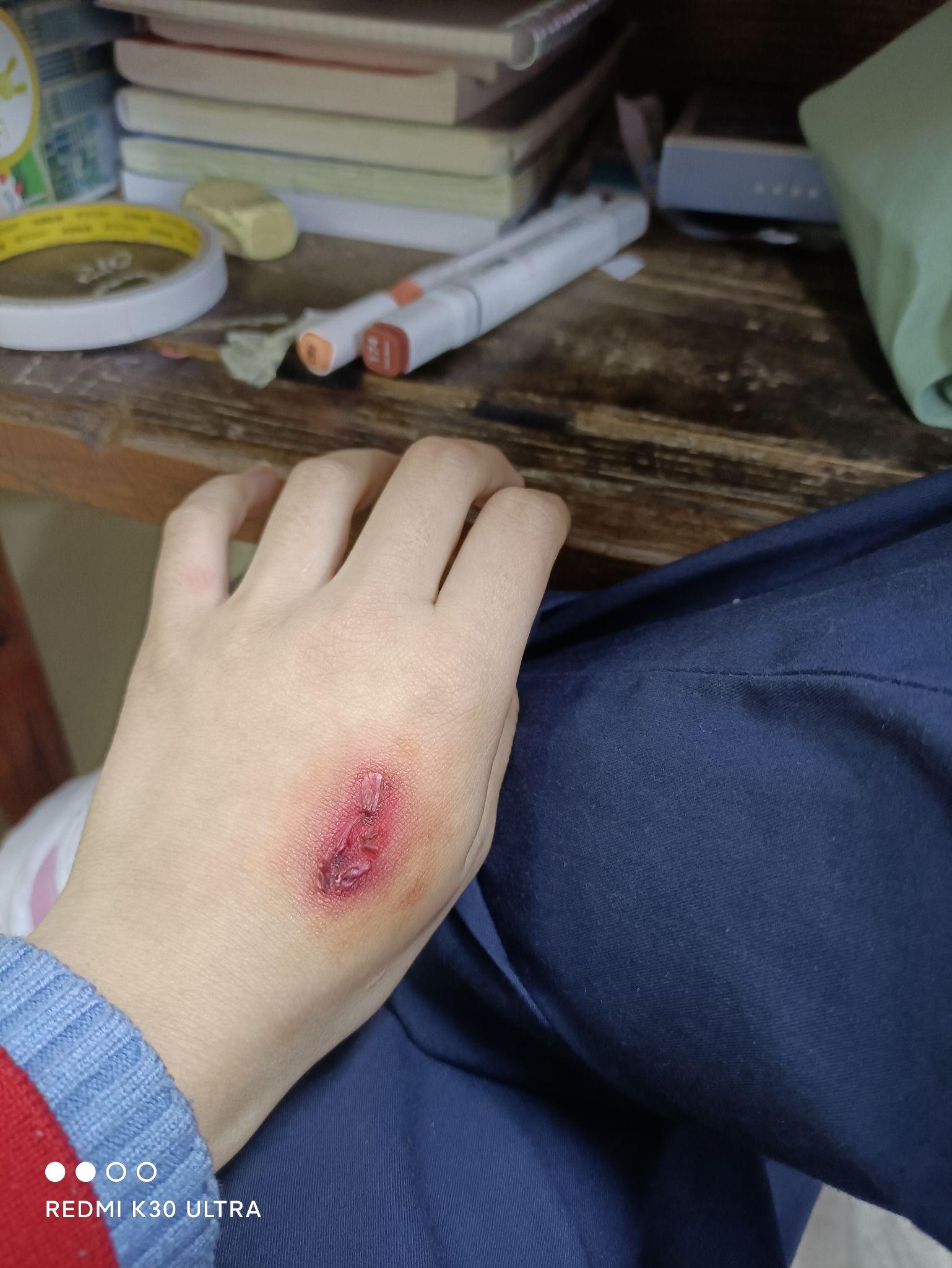 如何画出比较逼真的伤口? - 知乎