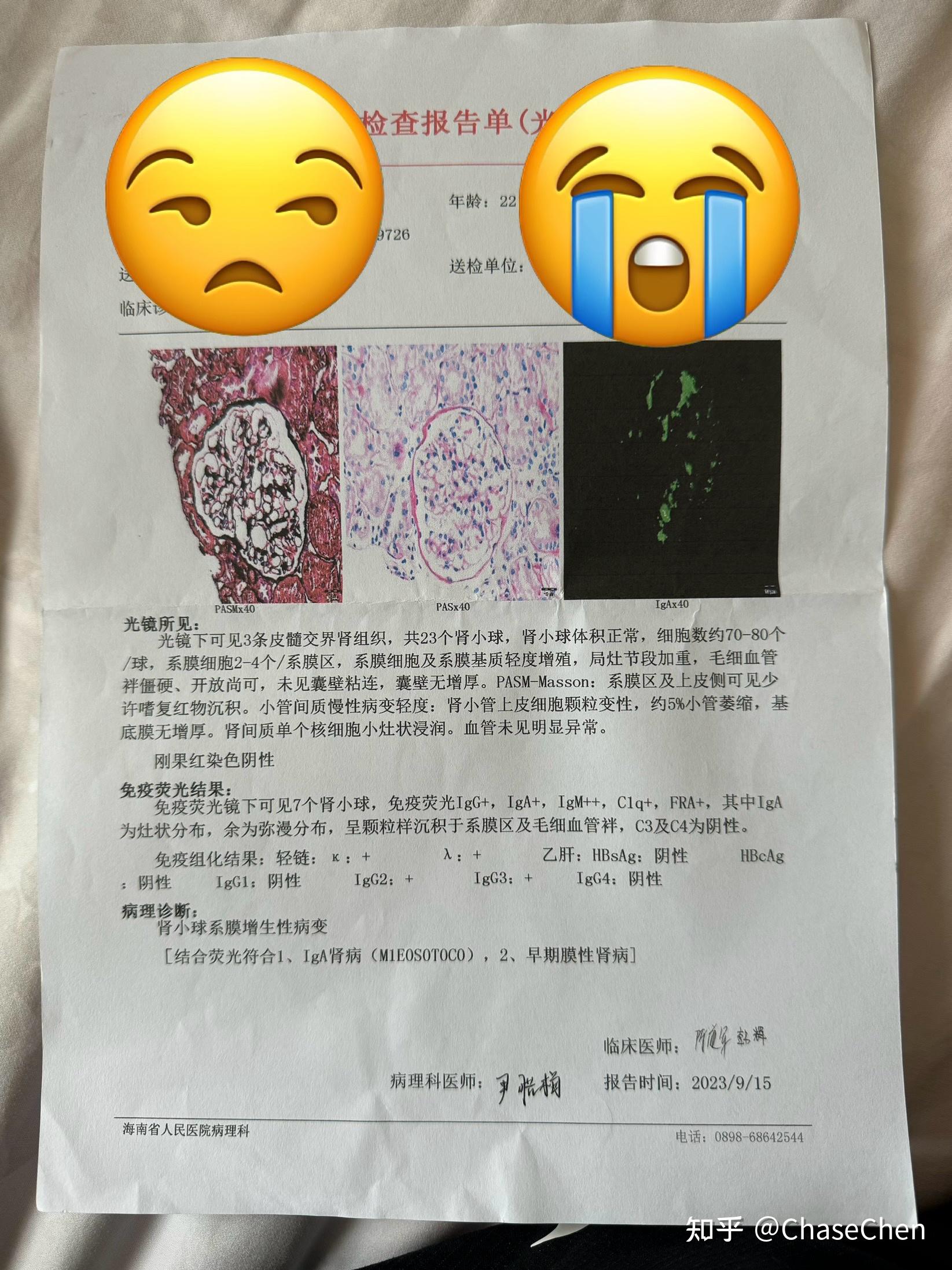 膜性肾病还是iga更严重啊?