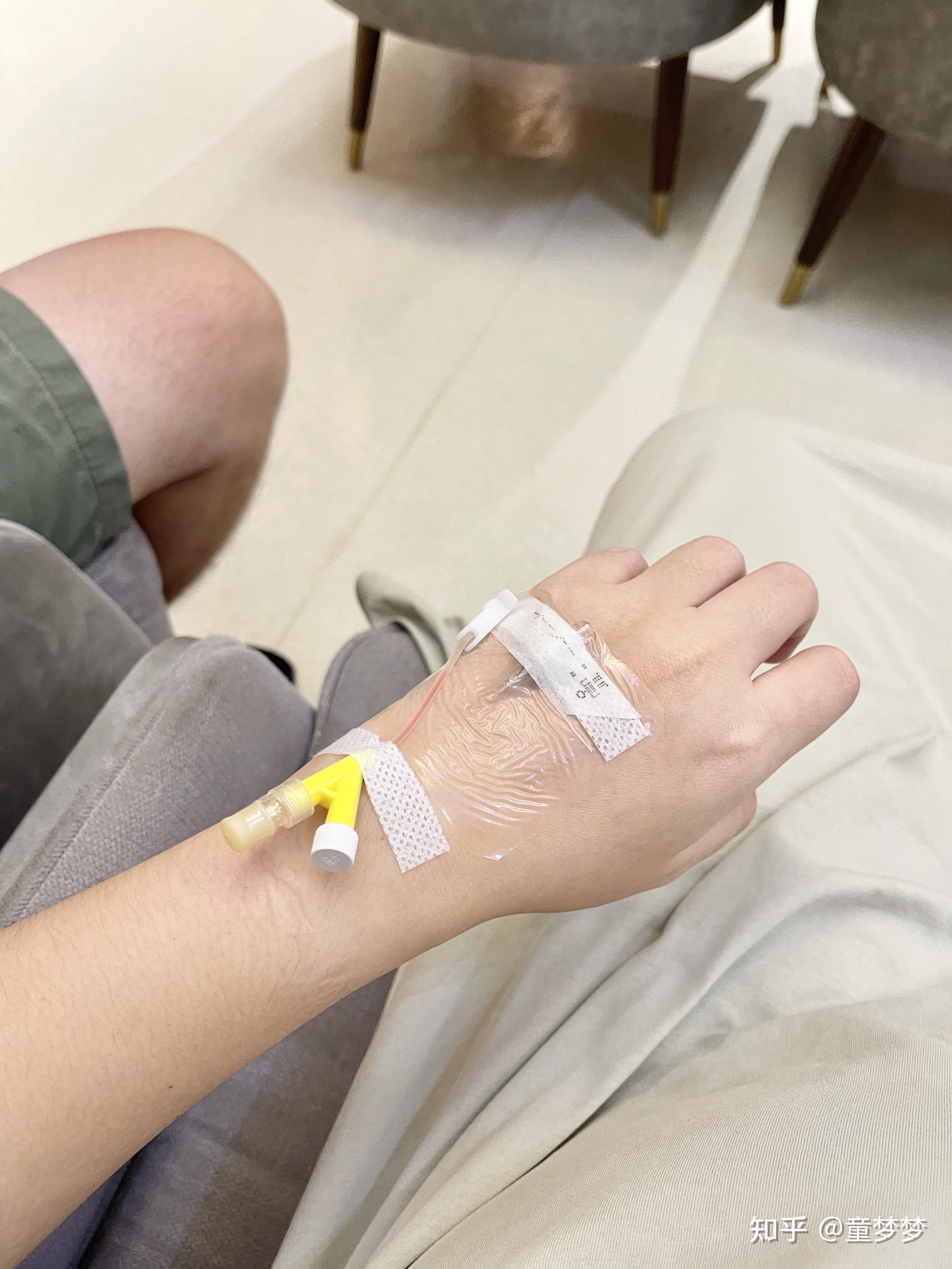 打留置针疼不疼