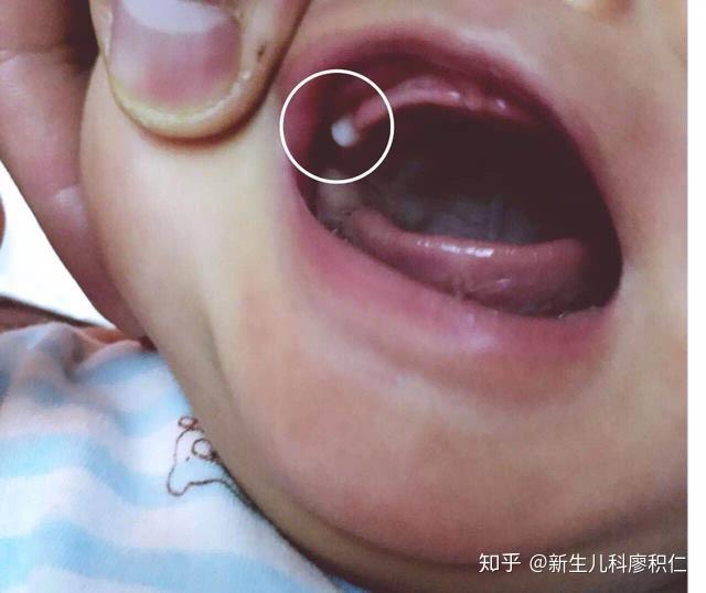 养育新生儿的过程中有哪些看起来吓人但其实很正常的生理现象