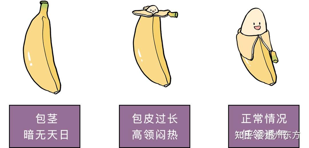 一定要割包皮吗?割包皮手术多少钱啊 ? - 知乎