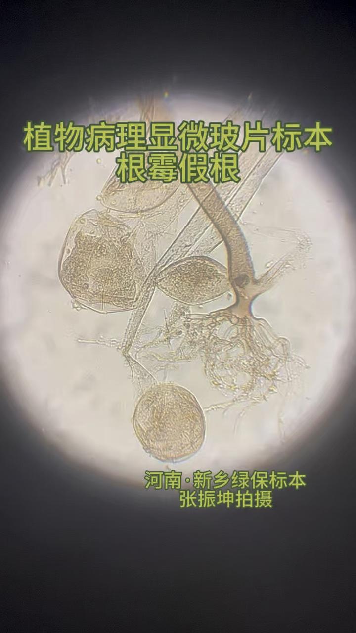 根霉假根 植物病理显微玻片生物切片农林高校植物保护专业学生实验实训教育教学农业研究智慧农业种植河南·新乡绿保植物病虫害标本工作室监制研发中心 ...