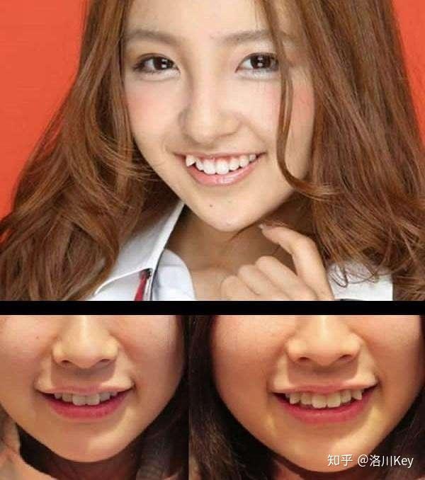 女生有虎牙是什么样的体验