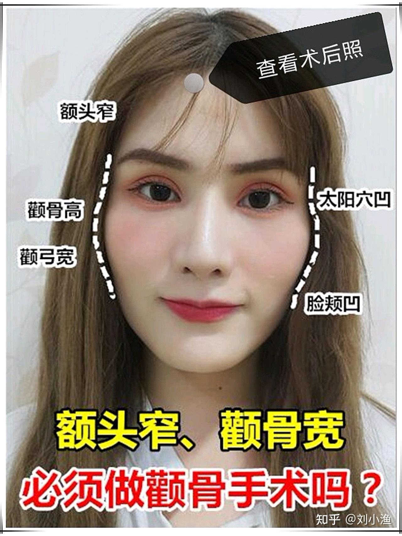 额头窄颧骨有点高脸型较宽大怎么弄? - 知乎