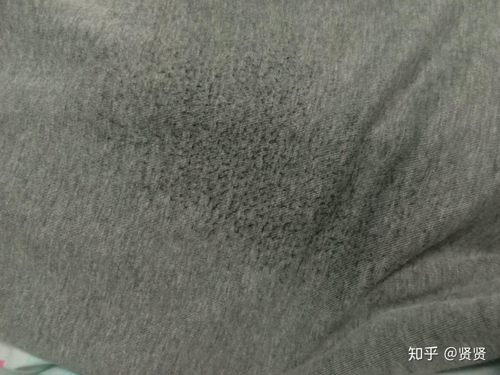 灰裤子后面有黑色的怎么回事?类似于起球但又不像是?