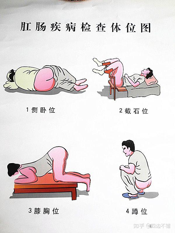 女性做痔疮手术会不会被医生看见隐私部位? - 知乎