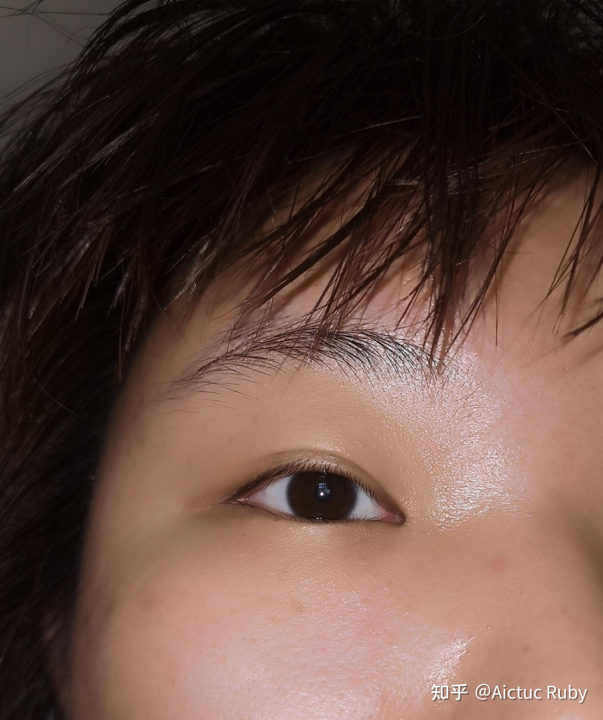 什么是双睫症?身边有这样的朋友吗? - 知乎