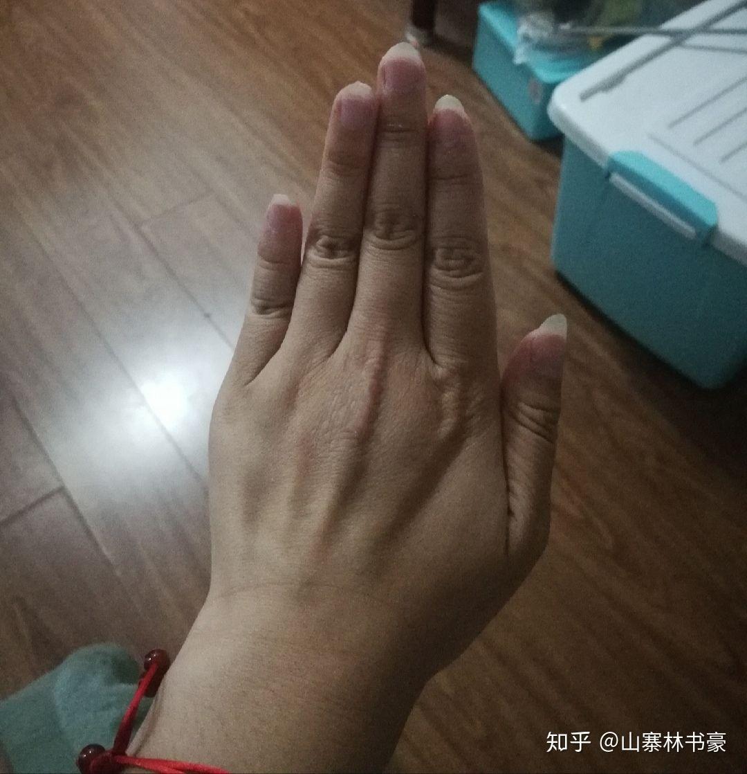 女生的手長得比男生還醜又短又粗是怎樣一種體驗