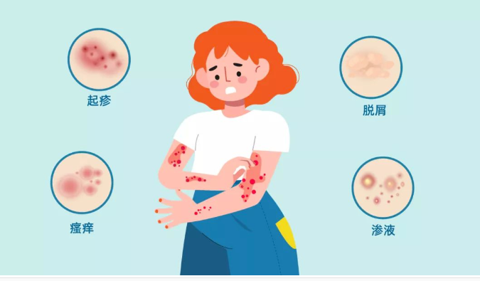 【肤康·科普】皮炎不及时治疗的危害有哪些? - 知乎