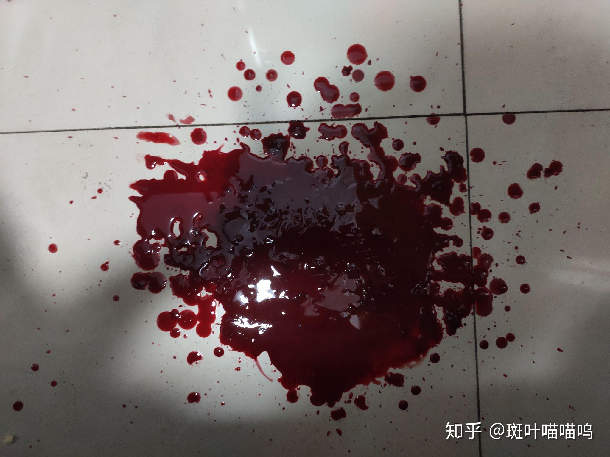 别人会不会看不起自残的人