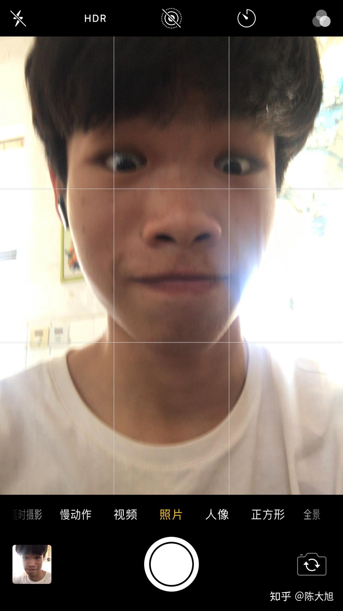 厚嘴唇,塌鼻子,单眼皮的男生还有救吗? - 知乎