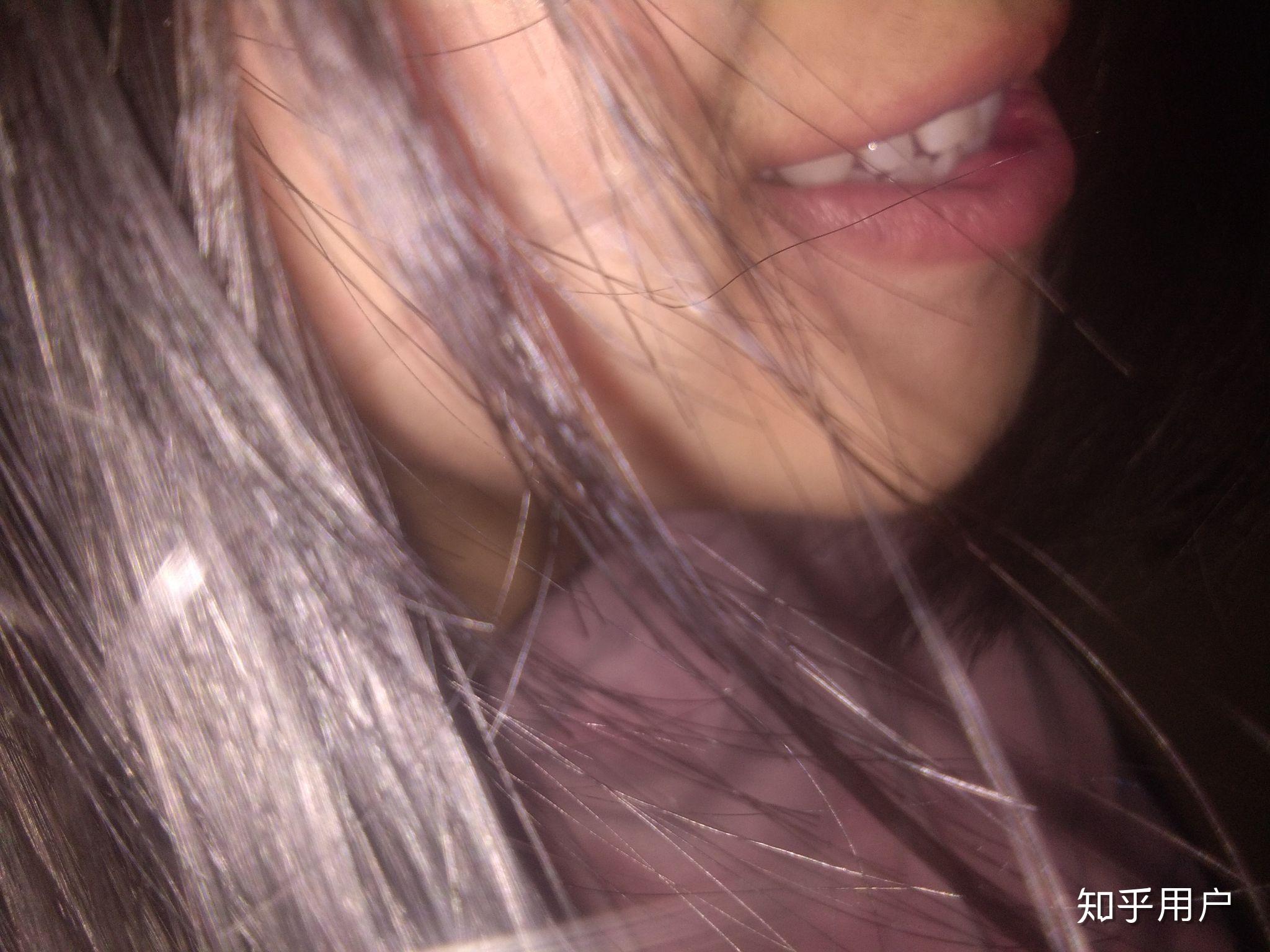 嘴唇厚而且外翻真的超级丑