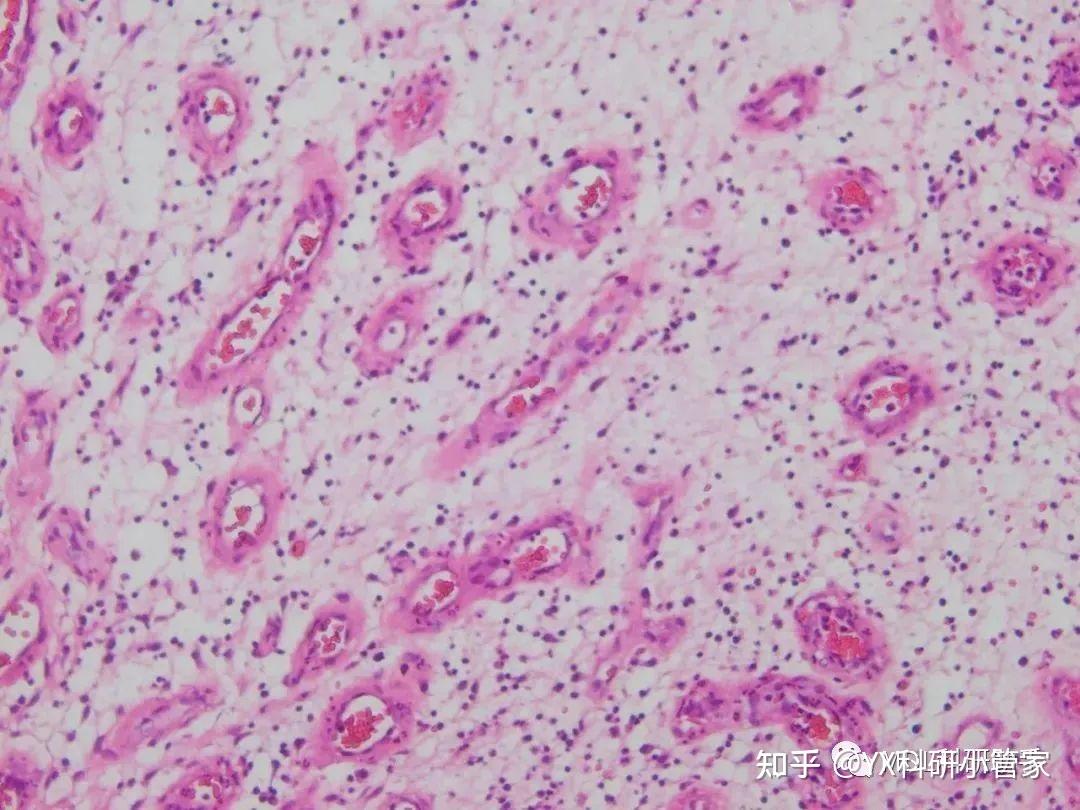常规病理组织切片及诊断要点