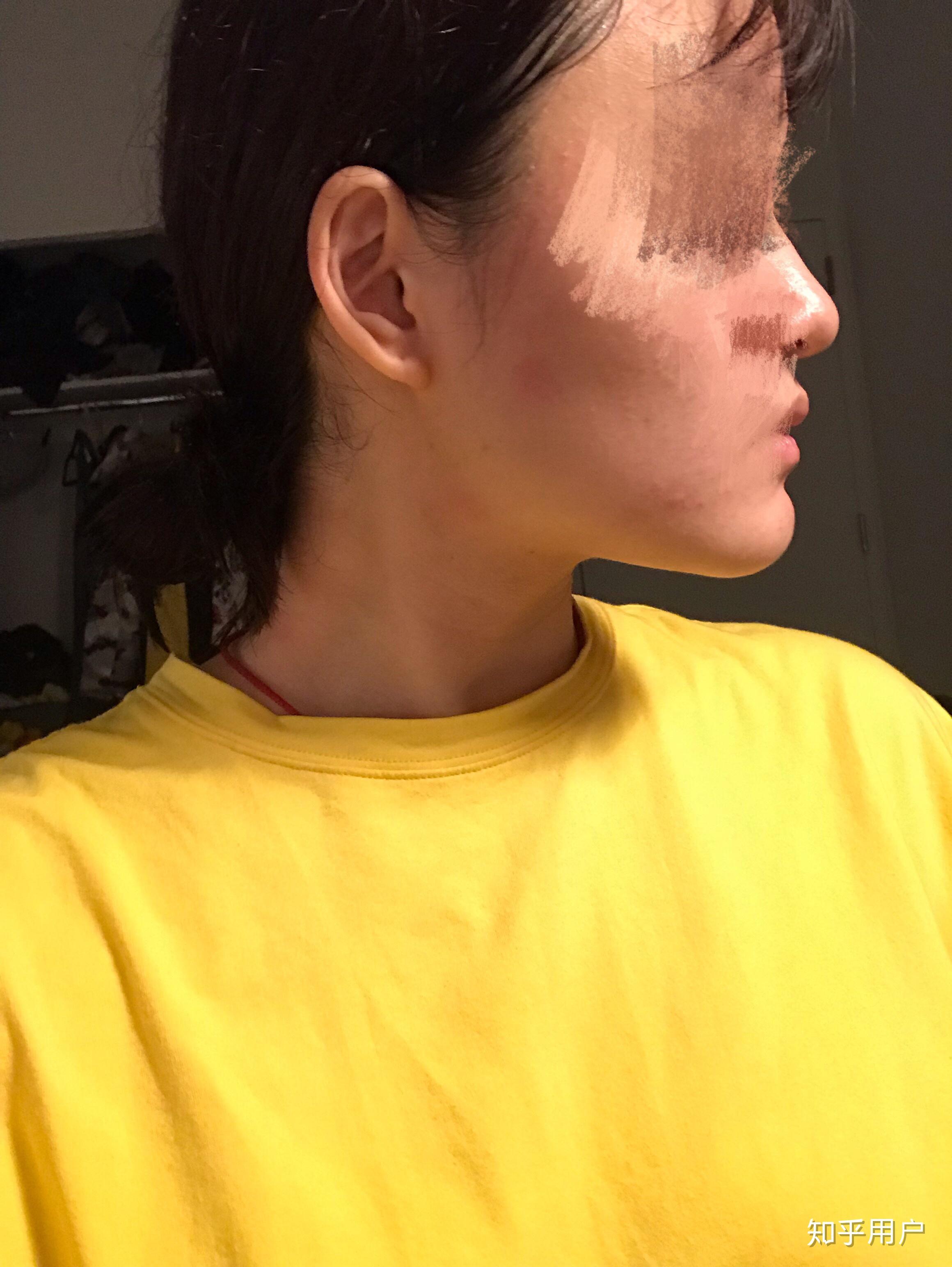 翘下巴月亮脸鞋拔子脸是不是很丑