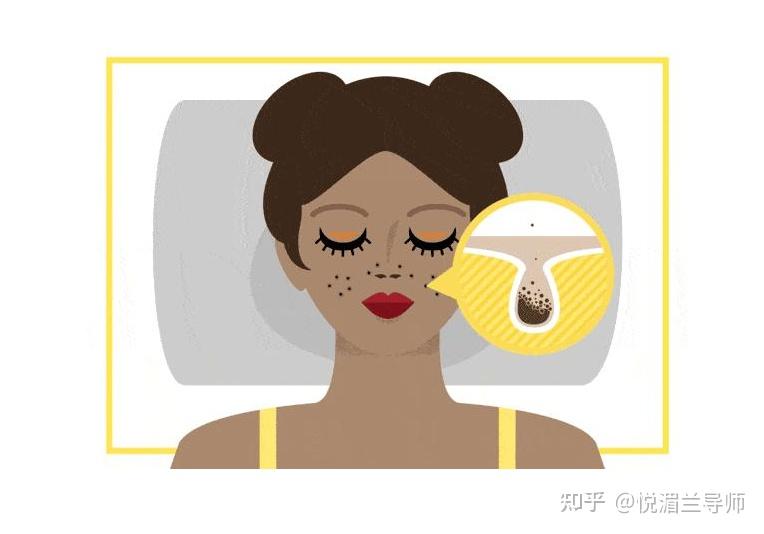 脸上毛孔大怎么调理?收缩毛孔的方法有哪些 - 知乎