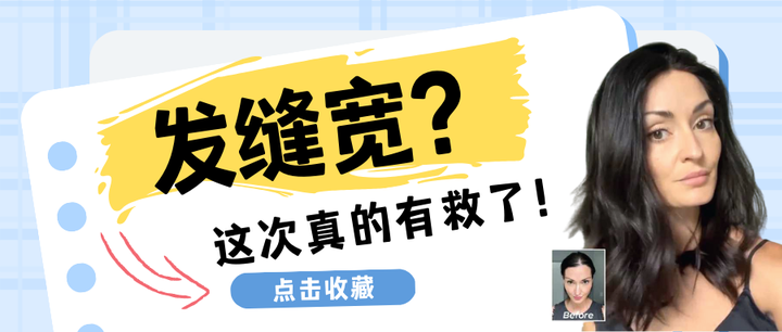 分发线变宽怎么办？如何有效解决？ - 知乎