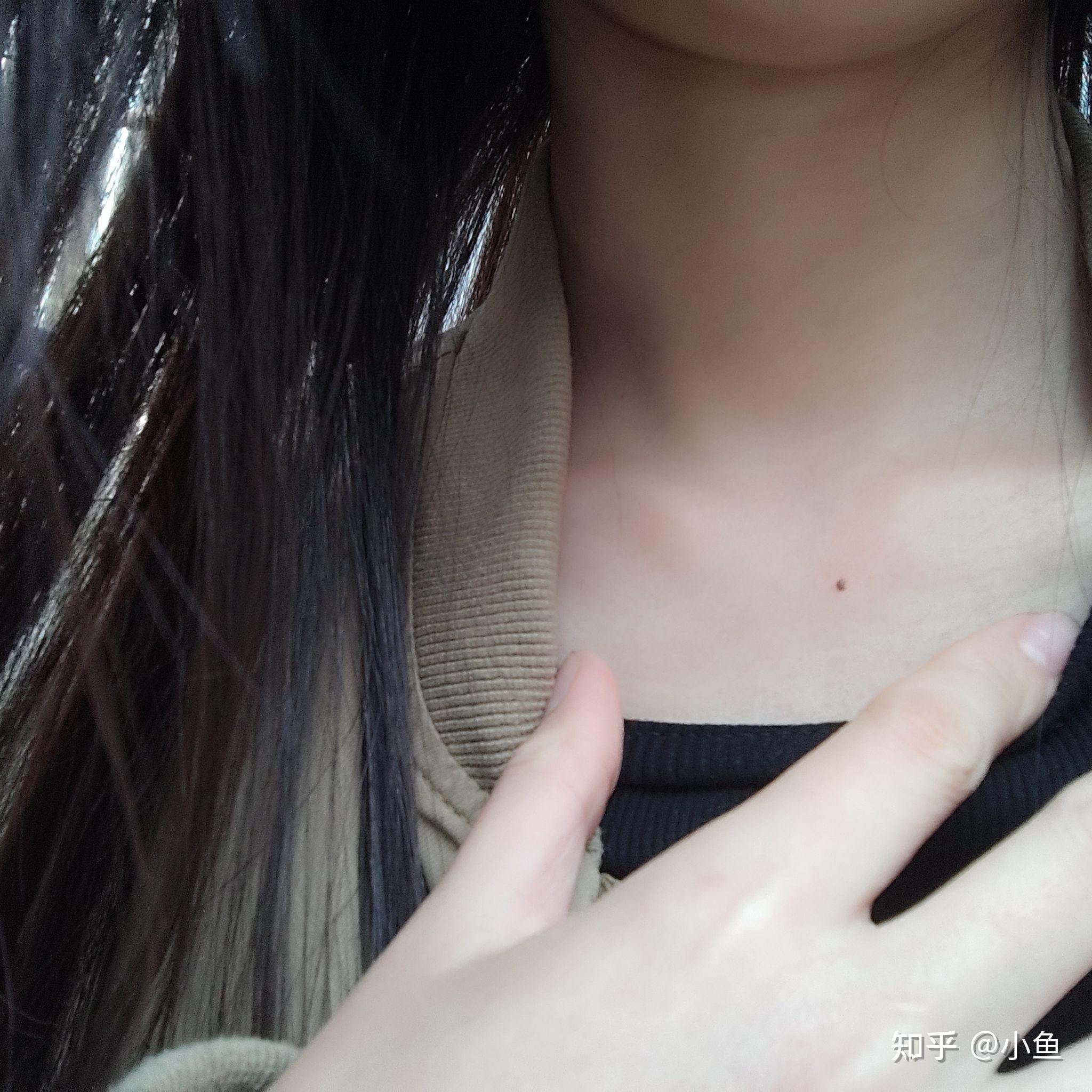 锁骨有痣 知乎