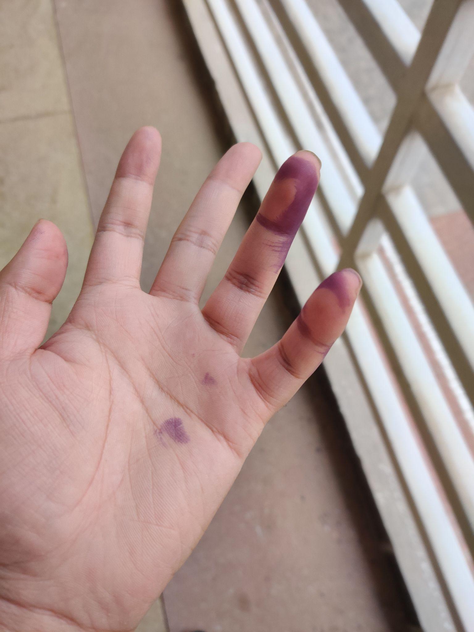 茚三酮为什么会使蛋白质显色