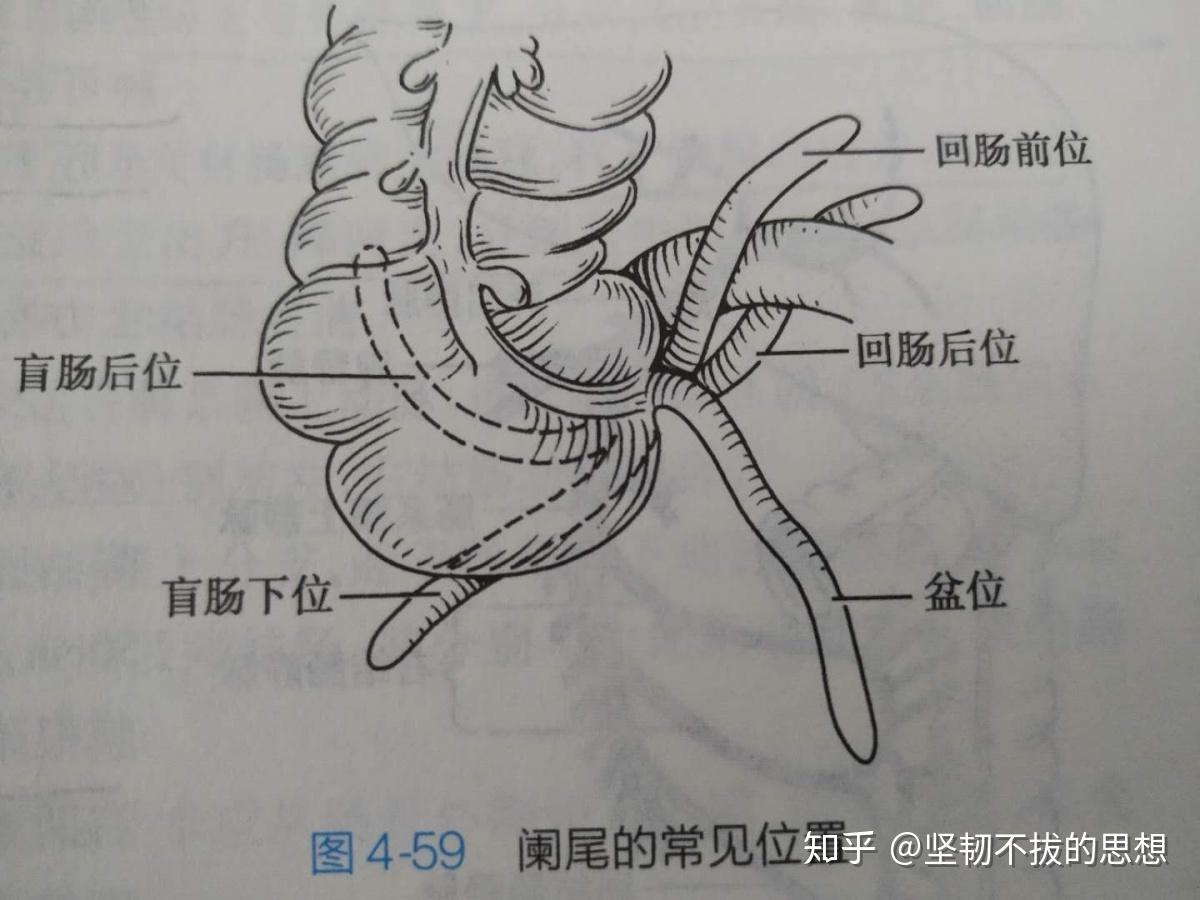 腹腔解剖图详细图-千图网