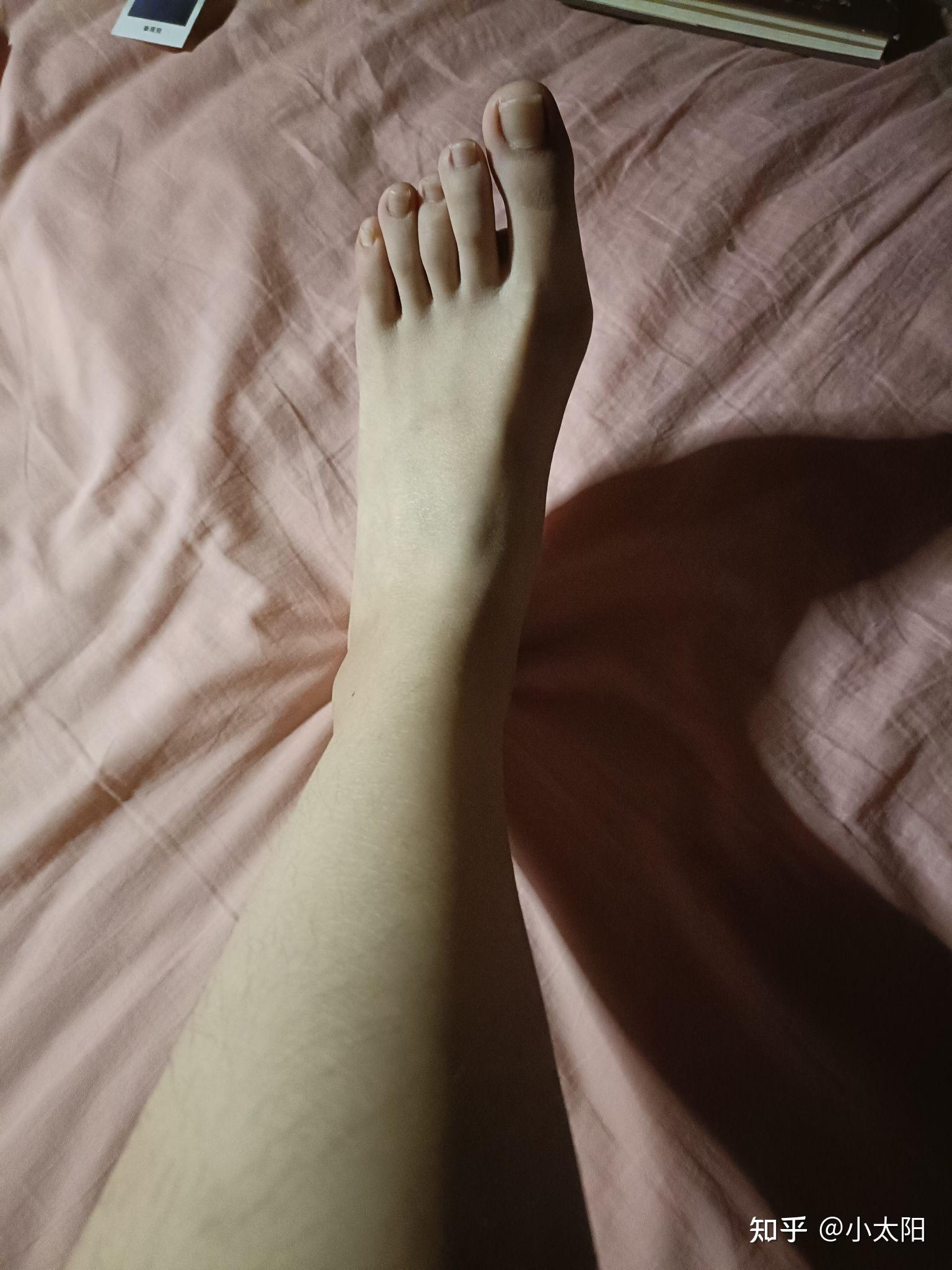 大脚趾特别长,比其他脚趾长很多的人,在现实中存在吗?