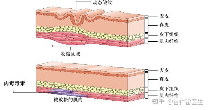 为什么每个人的额纹都不太一样？ - 知乎