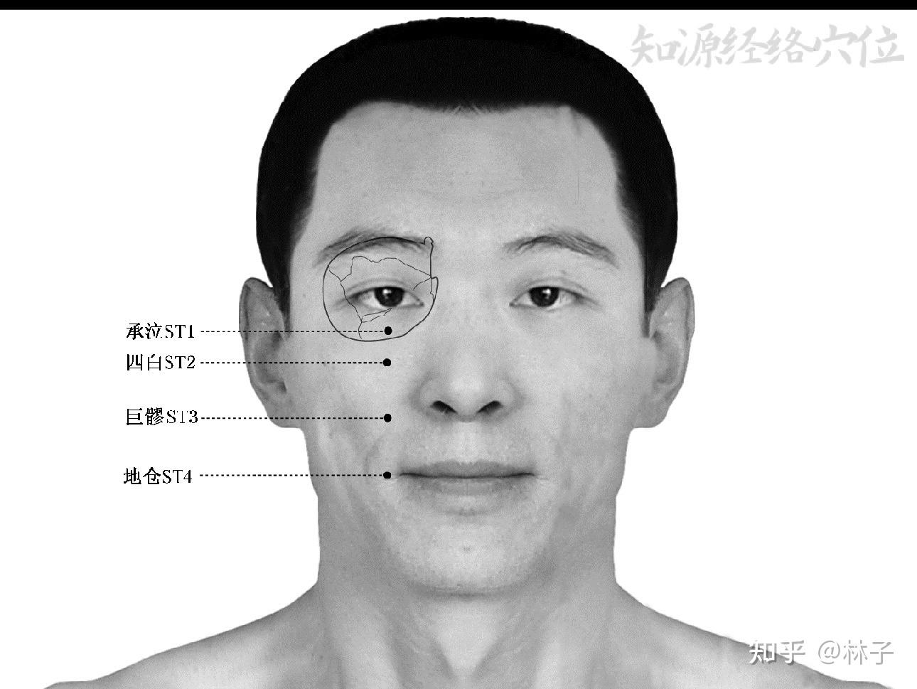 倪海厦人纪,针灸17 - 知乎