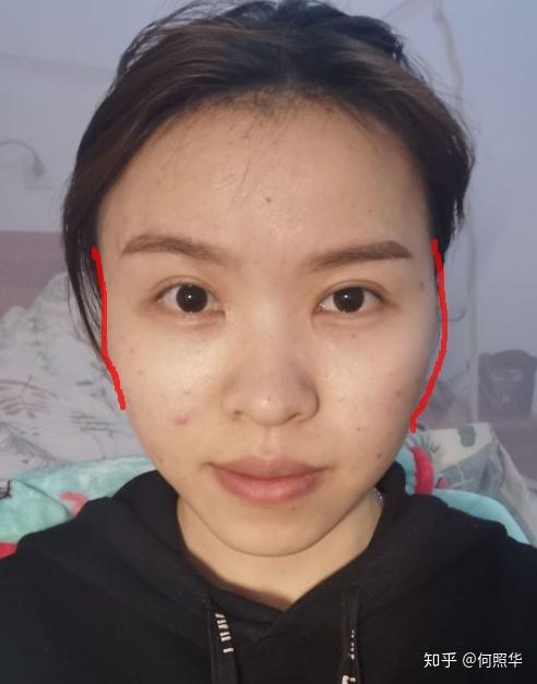 我的颧骨很高吗?外扩吗?