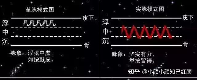 中医把脉手把手教,最全动图展示并心法口诀! - 知乎