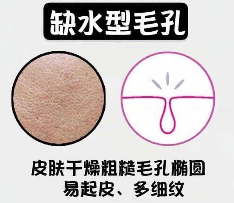 你的毛孔属于那种? - 知乎