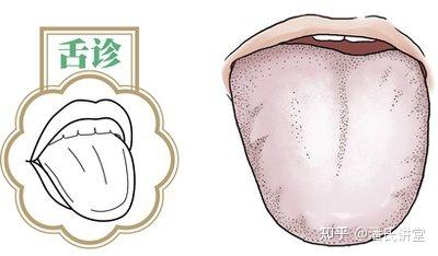 舌疹能判定脉象吗?看完你就懂了 - 知乎