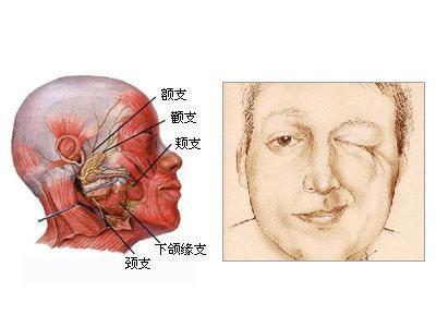 面肌痉挛脖子抽动是怎么回事? - 知乎