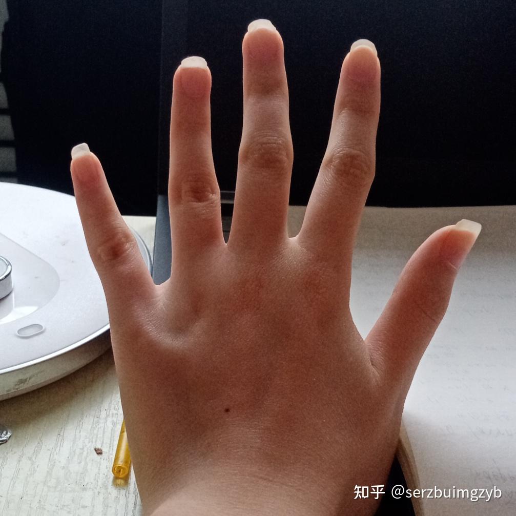 有同款歪手指吗? - 知乎