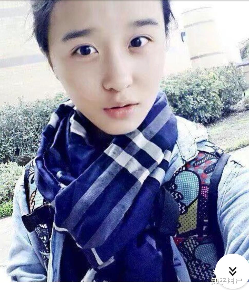 抖音里叫steph的网红动过刀子吗