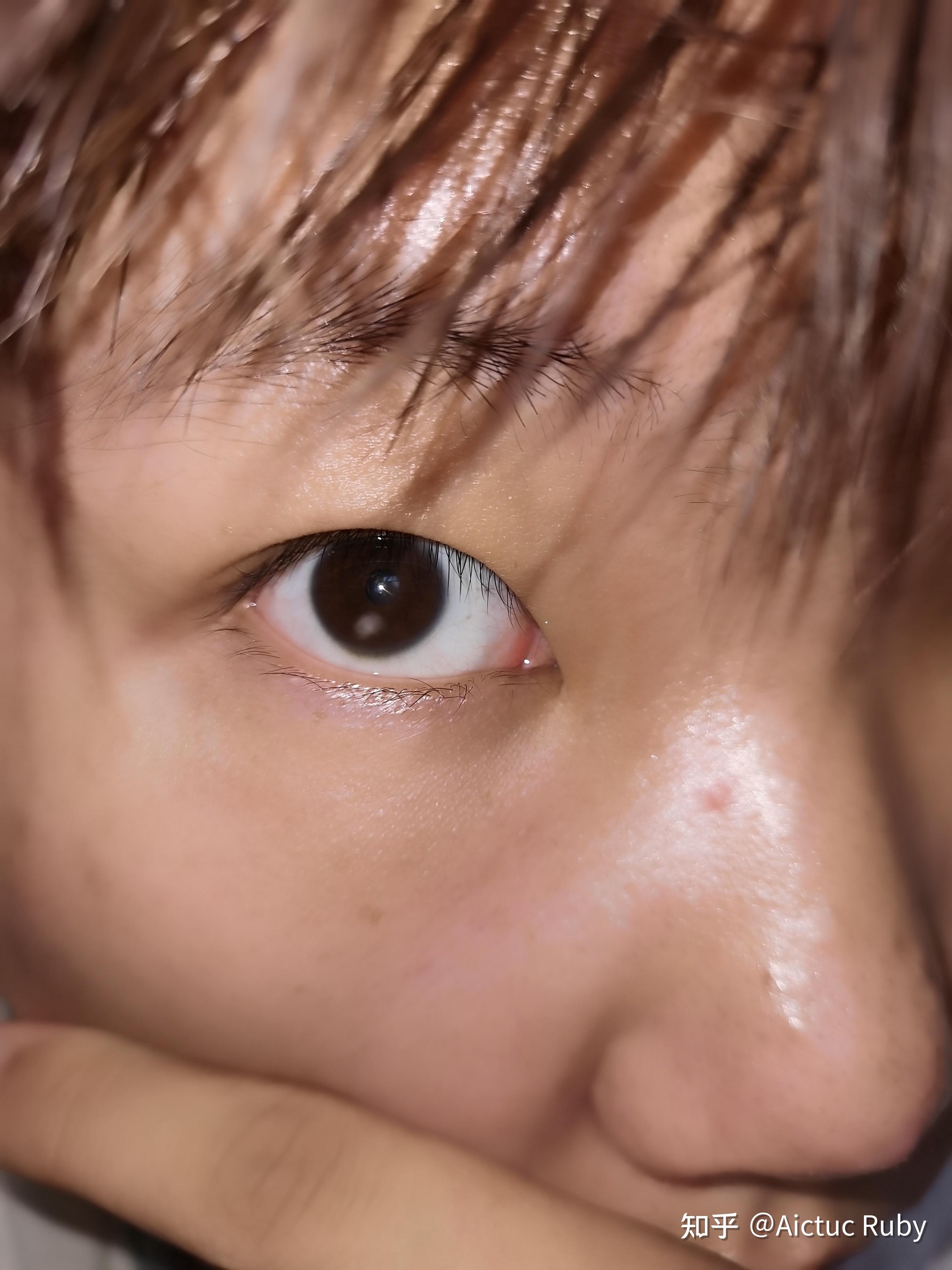 什么是双睫症?身边有这样的朋友吗? - 知乎