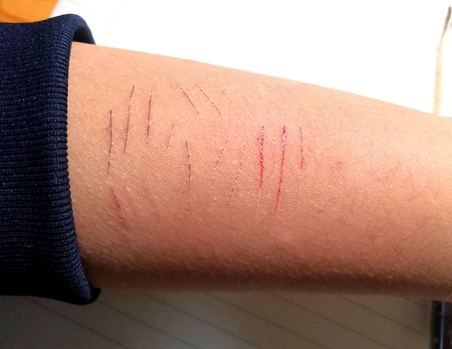 父母知道自己孩子自残会怎么样