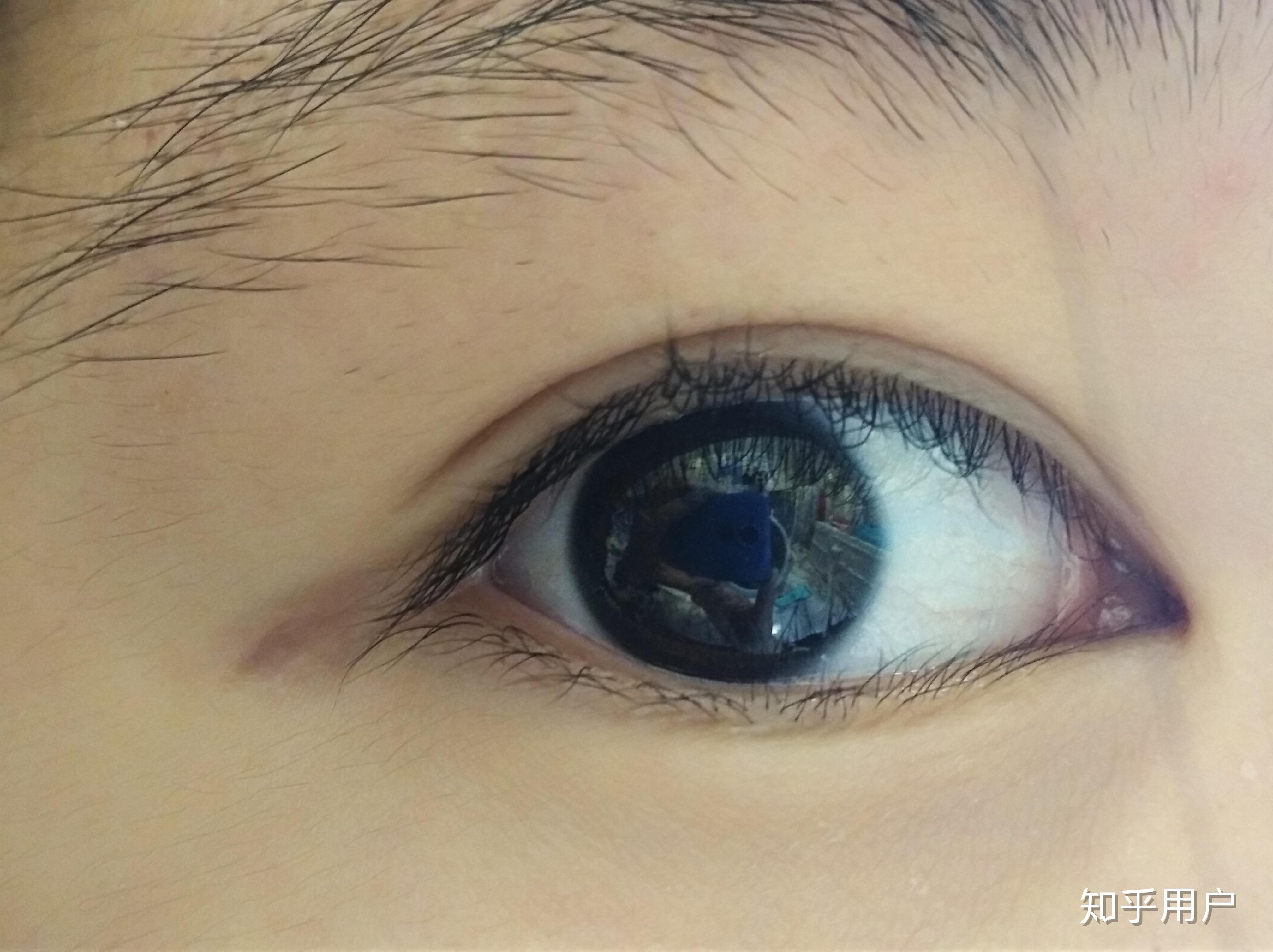 拥有一双清澈的眼睛是种什么体验