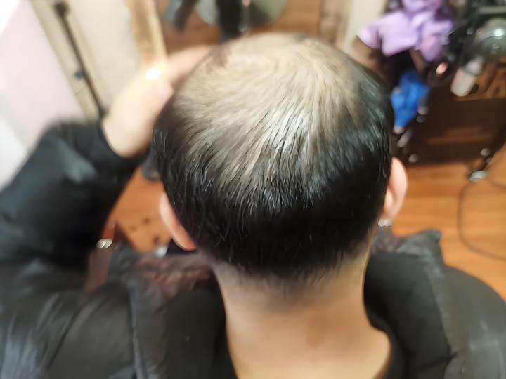 生发液什么牌子最有效果?揭秘十大生发液排名第一品牌! - 知乎