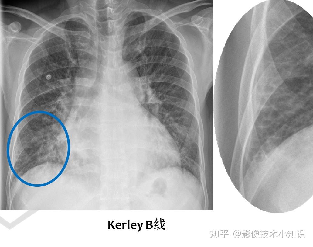 心脏的影像知识(2) - 知乎