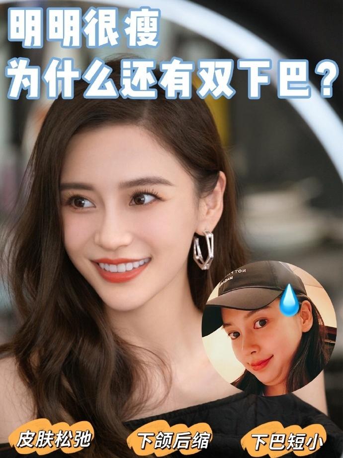 #青岛牙齿矫正:矫正一年缓解嘴突闭唇紧张,下颌逆旋出俏下巴 - 知乎