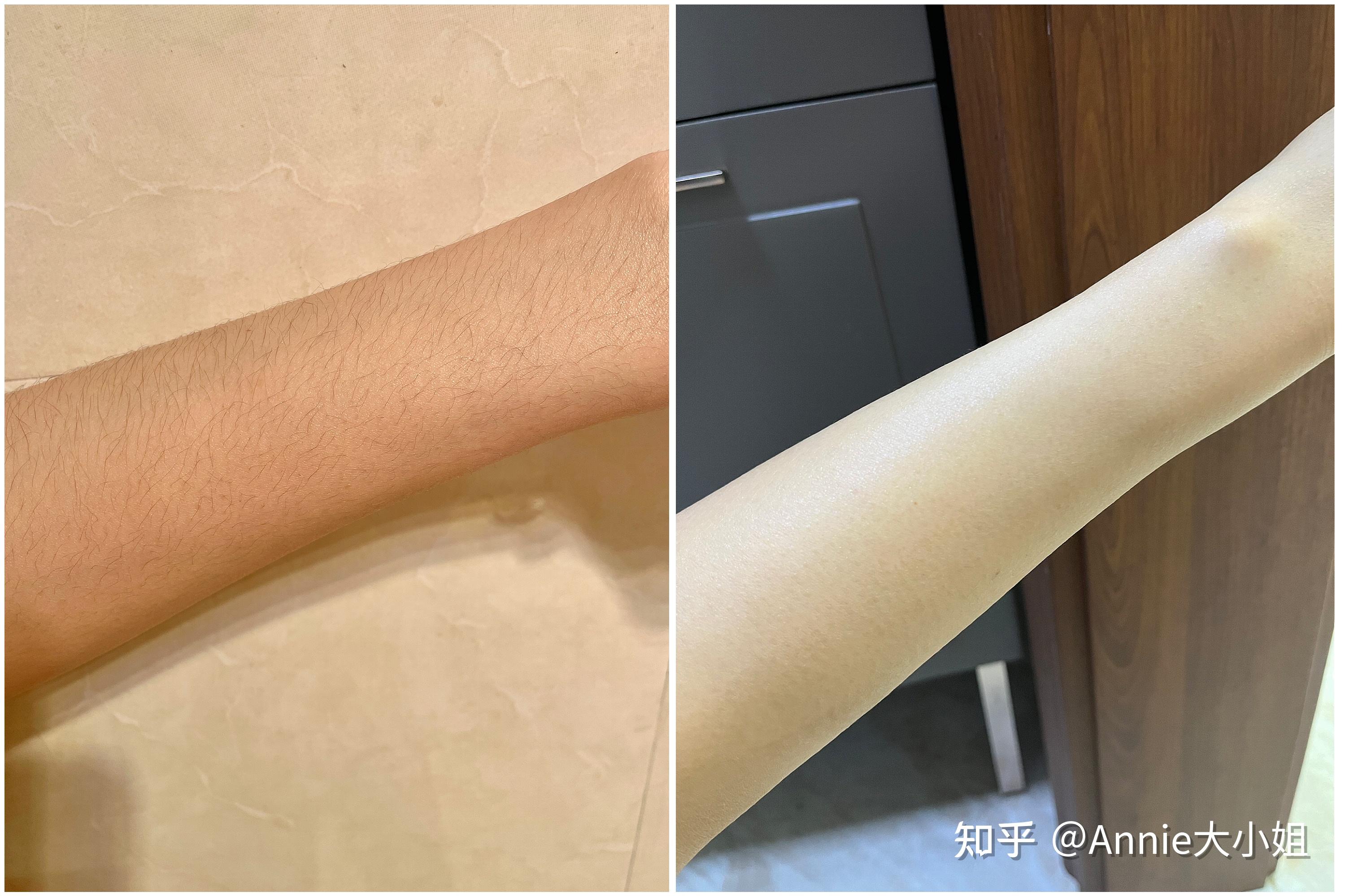 女生体毛旺盛是什么样的体验？