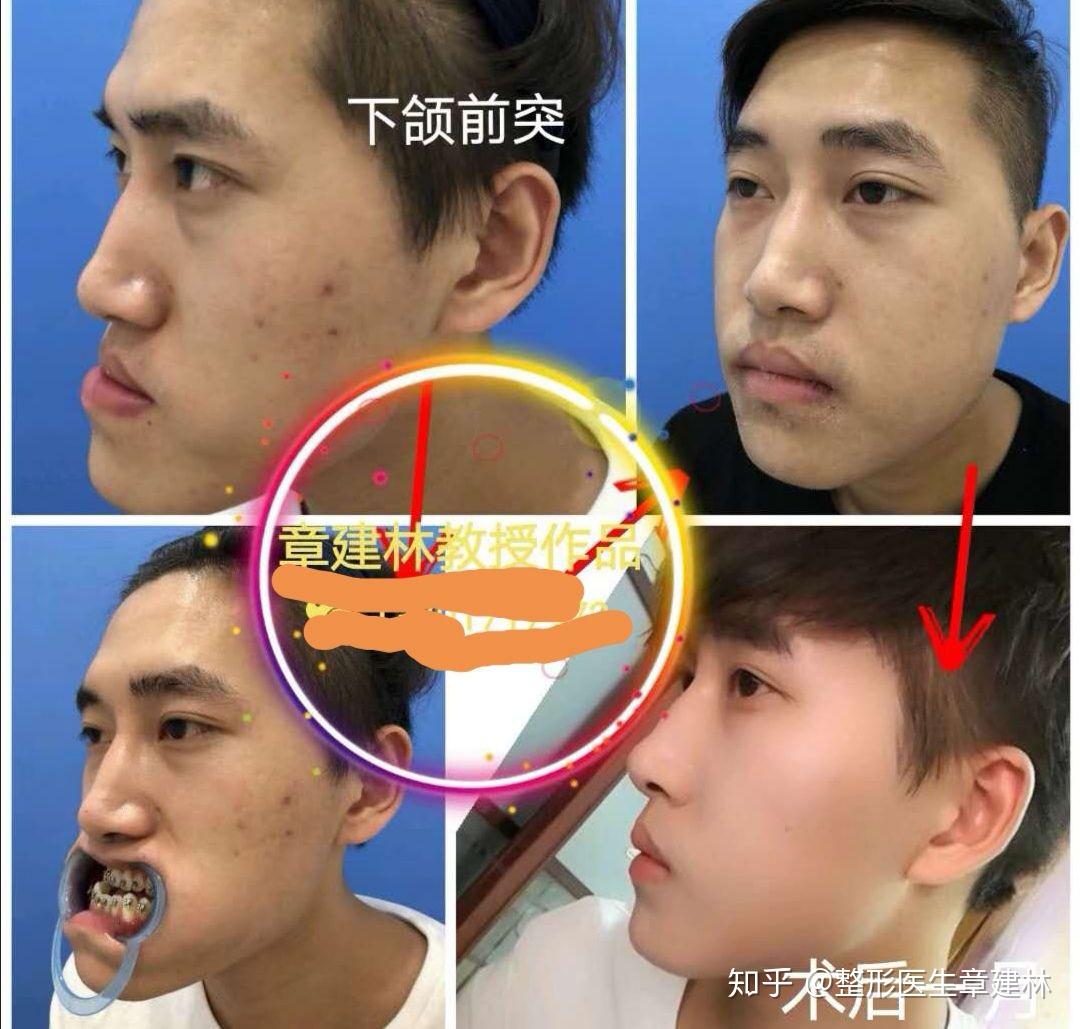 嘴唇地包天的男人图片