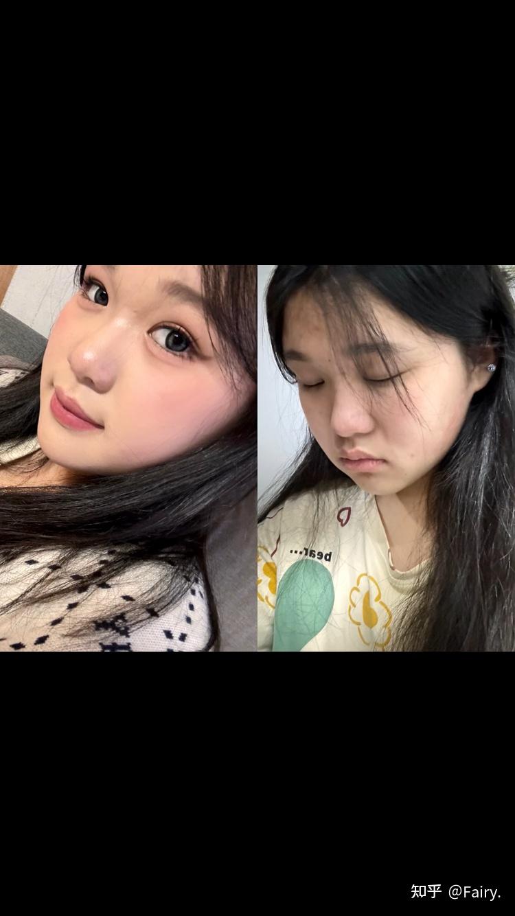 你见过鼻子塌但是又好看的女生吗