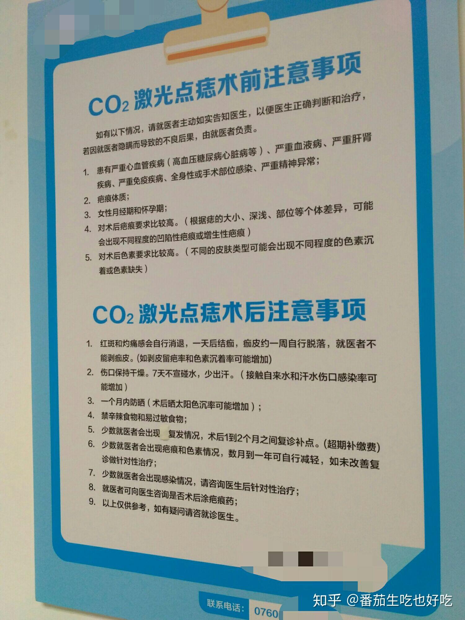 在三甲医院激光点痣点了一颗很小的痣花了200多块钱被坑了吗?