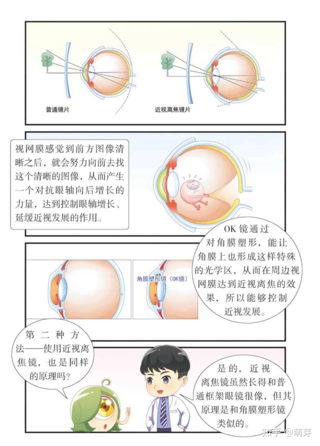 离焦镜是什么原理,真的可以缓解近视吗? - 知乎