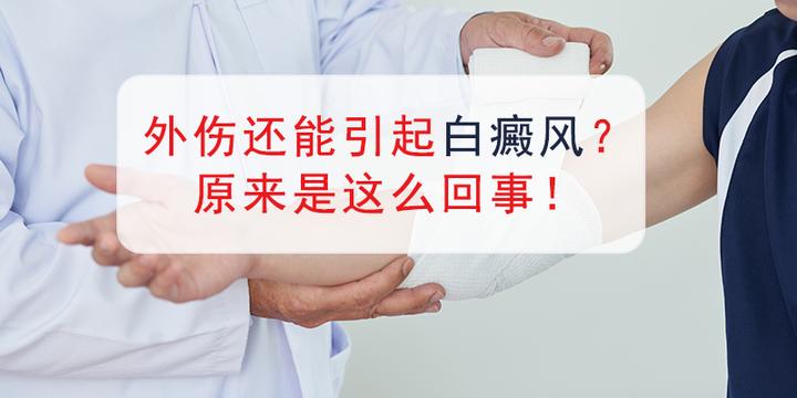 外伤诱发的白癜风有哪些特点 - 知乎