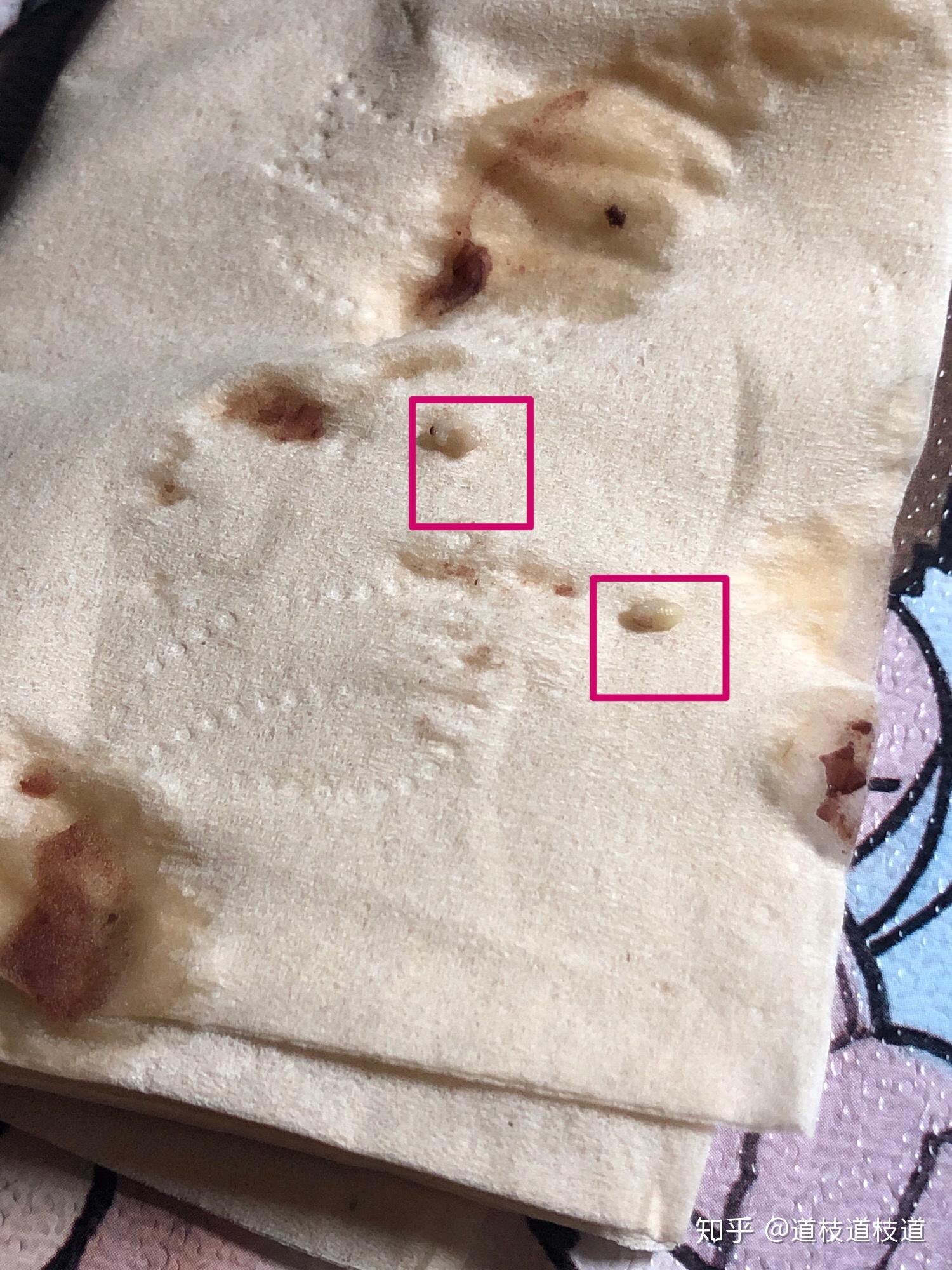 红豆汤里发现了这个是虫子吗