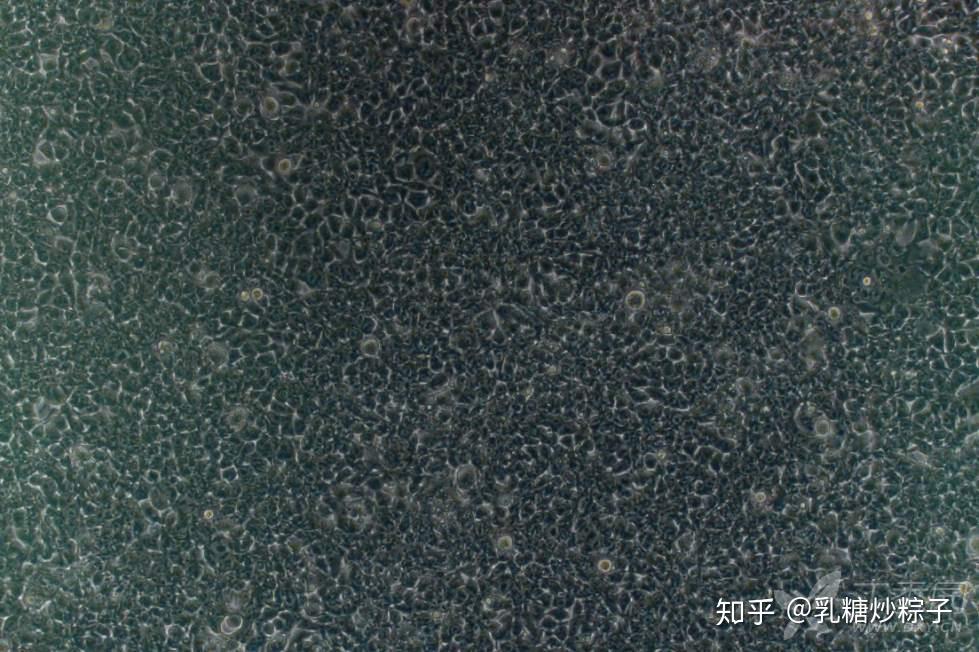 293T细胞状态识别与状态恢复（各种污染的处理办法）！！！ - 知乎