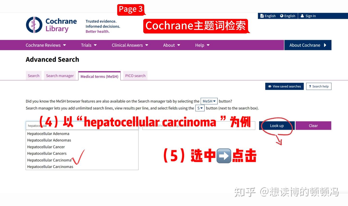 医学英文三大数据库主题词&自由词检索- 知乎 医学英文三大数据库主题词&自由词检索- 知乎