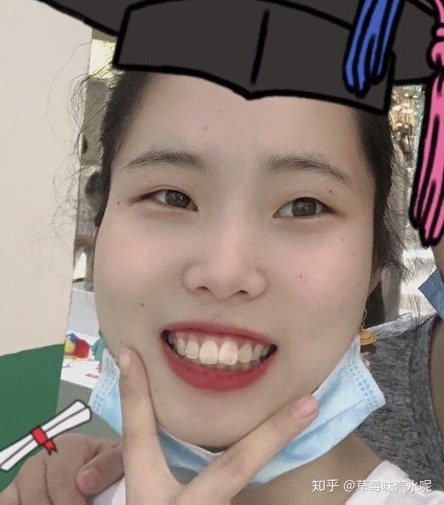 有没有那种龅牙了还好看的女生? - 知乎